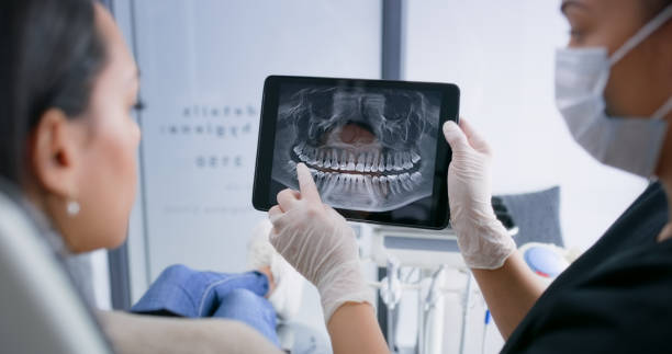Licensed Tooth Extraction service in Estes Park, CO - Smile Center Dentistry